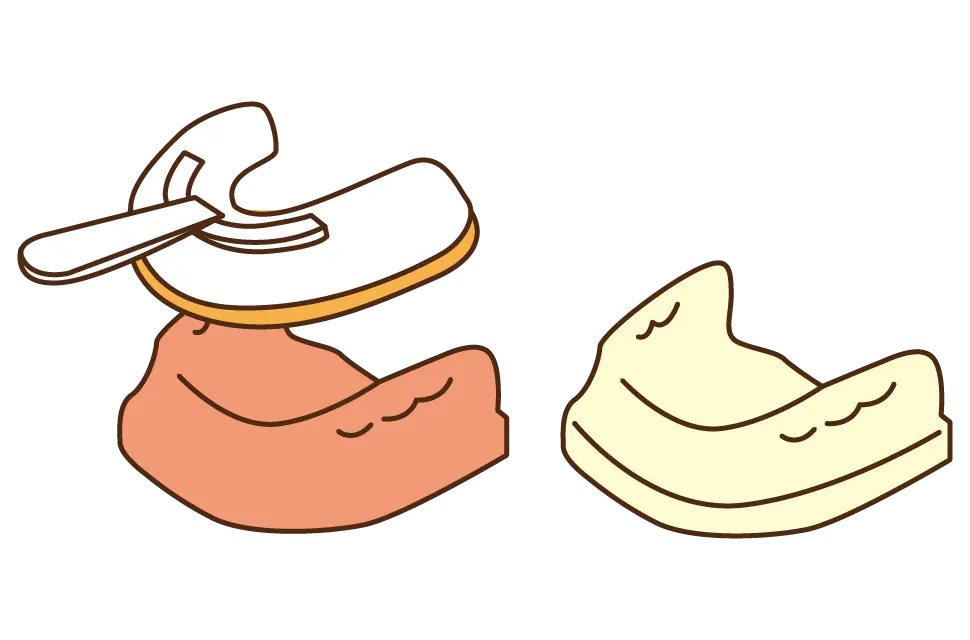 イメージ:①歯ぐきの型をとり、模型を作ります。